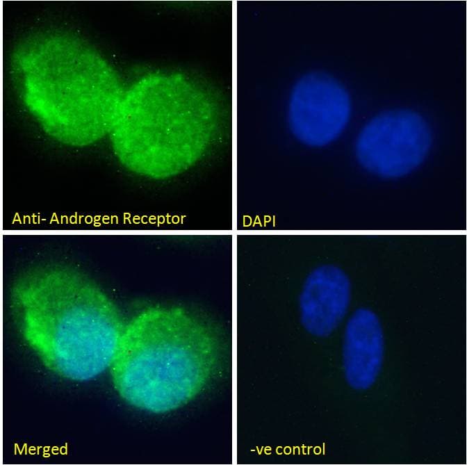 Polyclonal Goat anti-Human AR / Androgen Receptor Antibody (aa2-16, IHC, IF, WB)