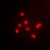 TP63 / p63 Antibody (C-Terminus)