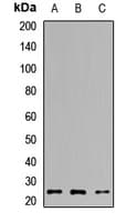 Polyclonal Rabbit anti-Human TPPP Antibody (WB)