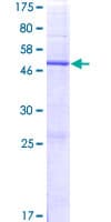 Human GPX8 Protein (Recombinant GST)