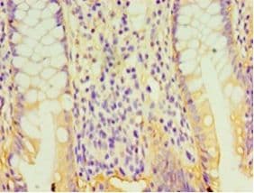 GPA33 / A33 Antibody (HRP)