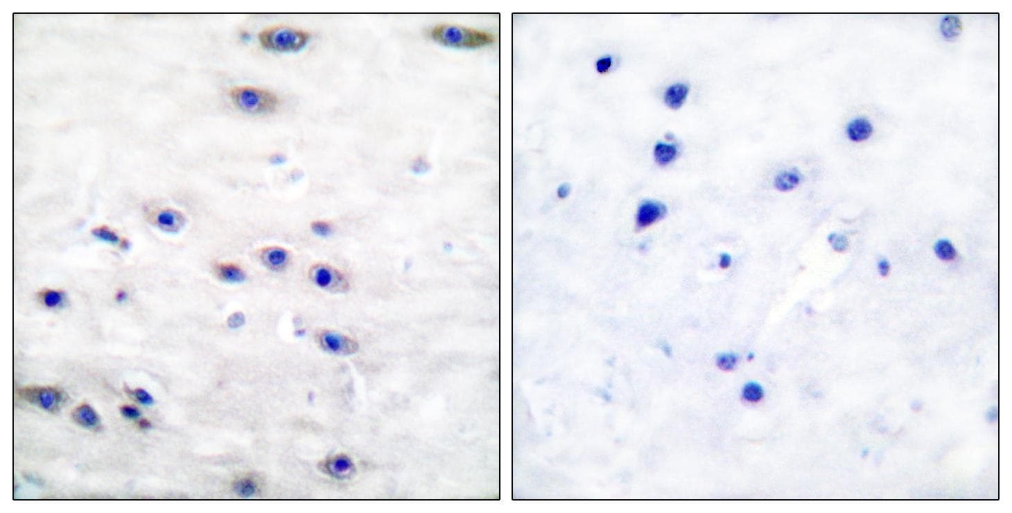 TH / Tyrosine Hydroxylase Antibody (p19)