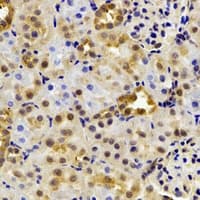 HIWI2 / PIWIL4 Antibody