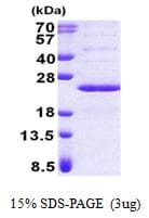 Human PPP1R11 Protein (Recombinant His)