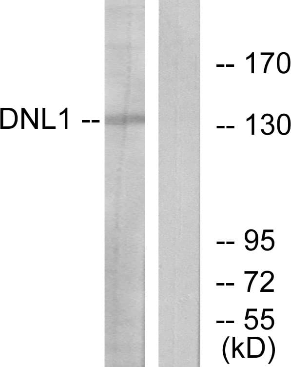 IHC-plus™ LIG1 / DNA Ligase 1 Antibody (aa111-160)