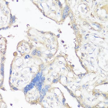 VTN / Vitronectin Antibody
