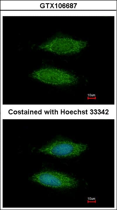 C11orf85 Antibody (aa1-206)