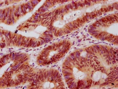 HIST1H2BN Antibody