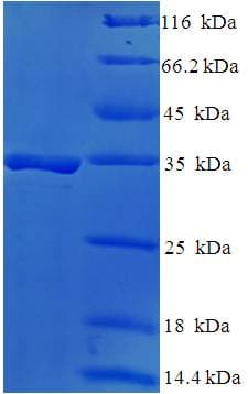 Human DAND5 Protein (Recombinant His-SUMO)