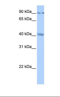 Polyclonal Rabbit anti-Human CATSPERG Antibody (aa928-977, WB)