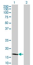 LCN1 / Lipocalin-1 Antibody (clone 1B11)