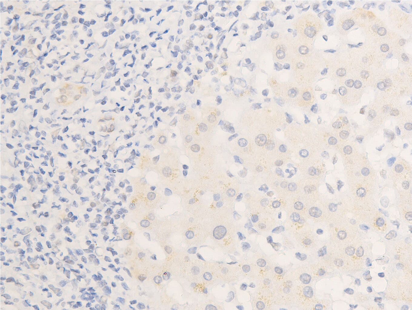 EGFR Antibody (phospho-Ser1026)