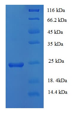 Human SOCS1 Protein (Recombinant 6His, N-terminus)