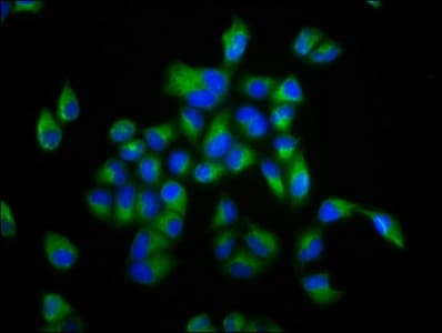 IHC-plus™ FBP / FOLR2 Antibody