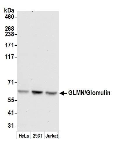GLMN Antibody (aa544-594)