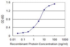 IHC-plus™ SLC11A2 / DMT1 Antibody (clone 4C6)