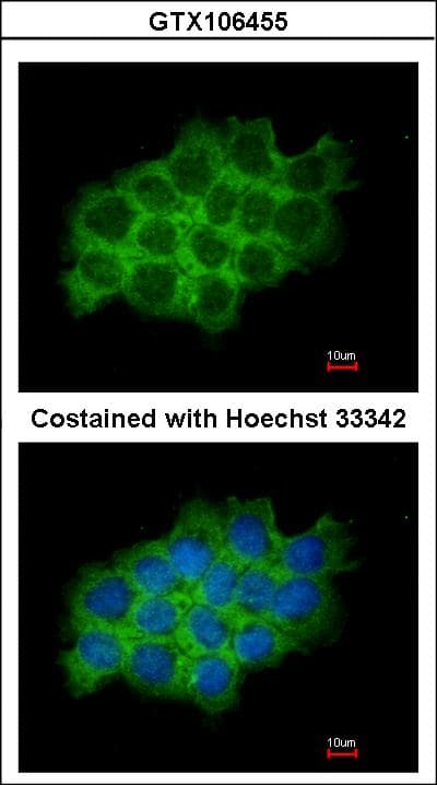 SEC61A1 / SEC61 Antibody (aa413-476)