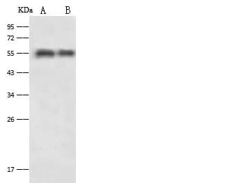 Polyclonal Rabbit anti-Rat SERPINA1 / Alpha 1 Antitrypsin Antibody (Preservative Free, WB)