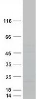 Human ORMDL3 Protein (Recombinant Myc-DDK (Flag))