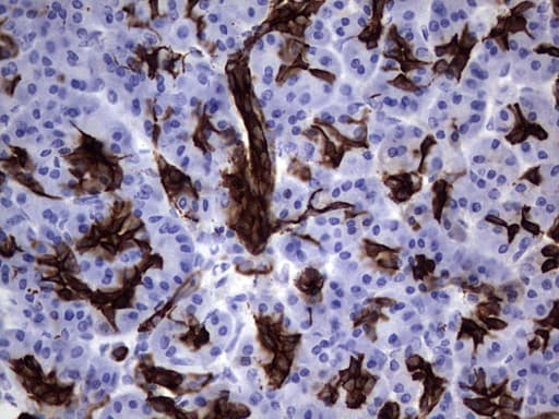 Monoclonal Mouse anti-Human KRT19 / CK19 / Cytokeratin 19 Antibody (clone OTI9A9, aa240-390, IHC)
