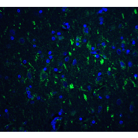 FOXP3 Antibody
