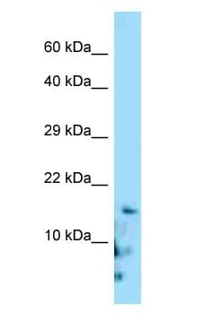 Polyclonal Rabbit anti-Human Gastrin Releasing Peptide Antibody (C-Terminus, WB)