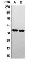 IHC-plus™ Polyclonal Rabbit anti-Human STK17B / DRAK2 Antibody (Internal, IHC, WB)
