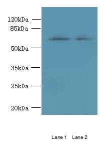 TBC1D19 Antibody