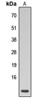 PLN / Phospholamban Antibody (N-Terminus)
