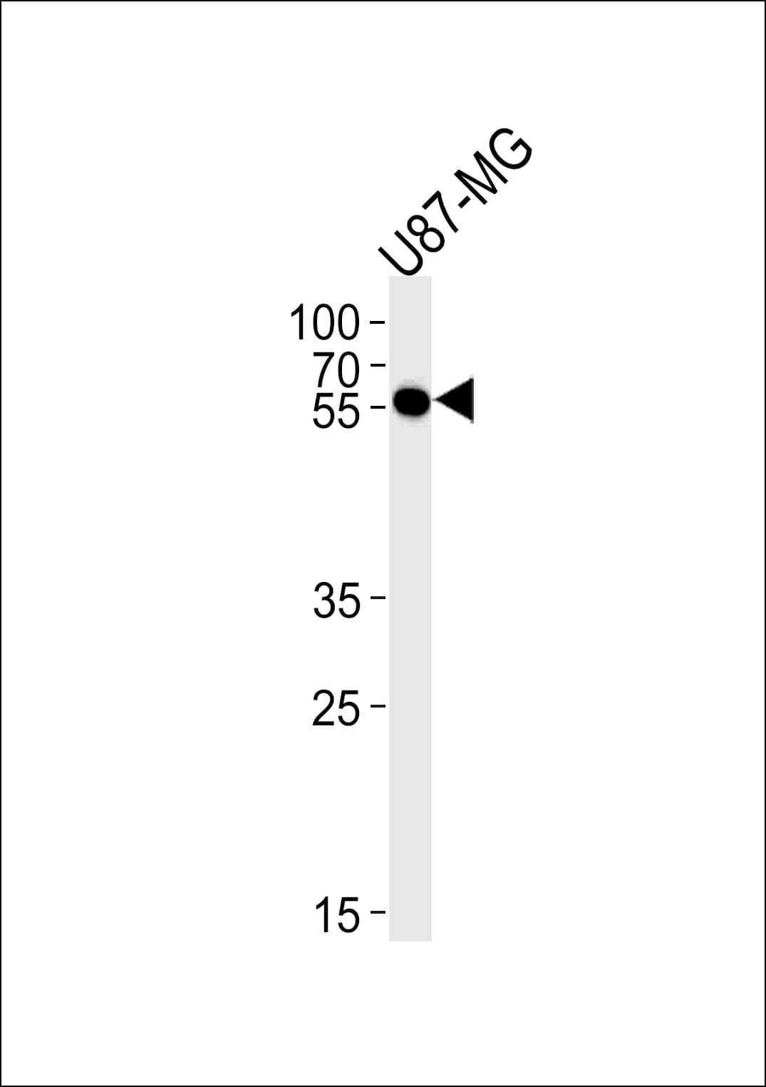 CMAS Antibody (aa300-327)