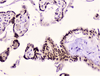 RAD51 / RECA Antibody