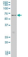 FOXO1 / FKHR Antibody (clone 3A10)