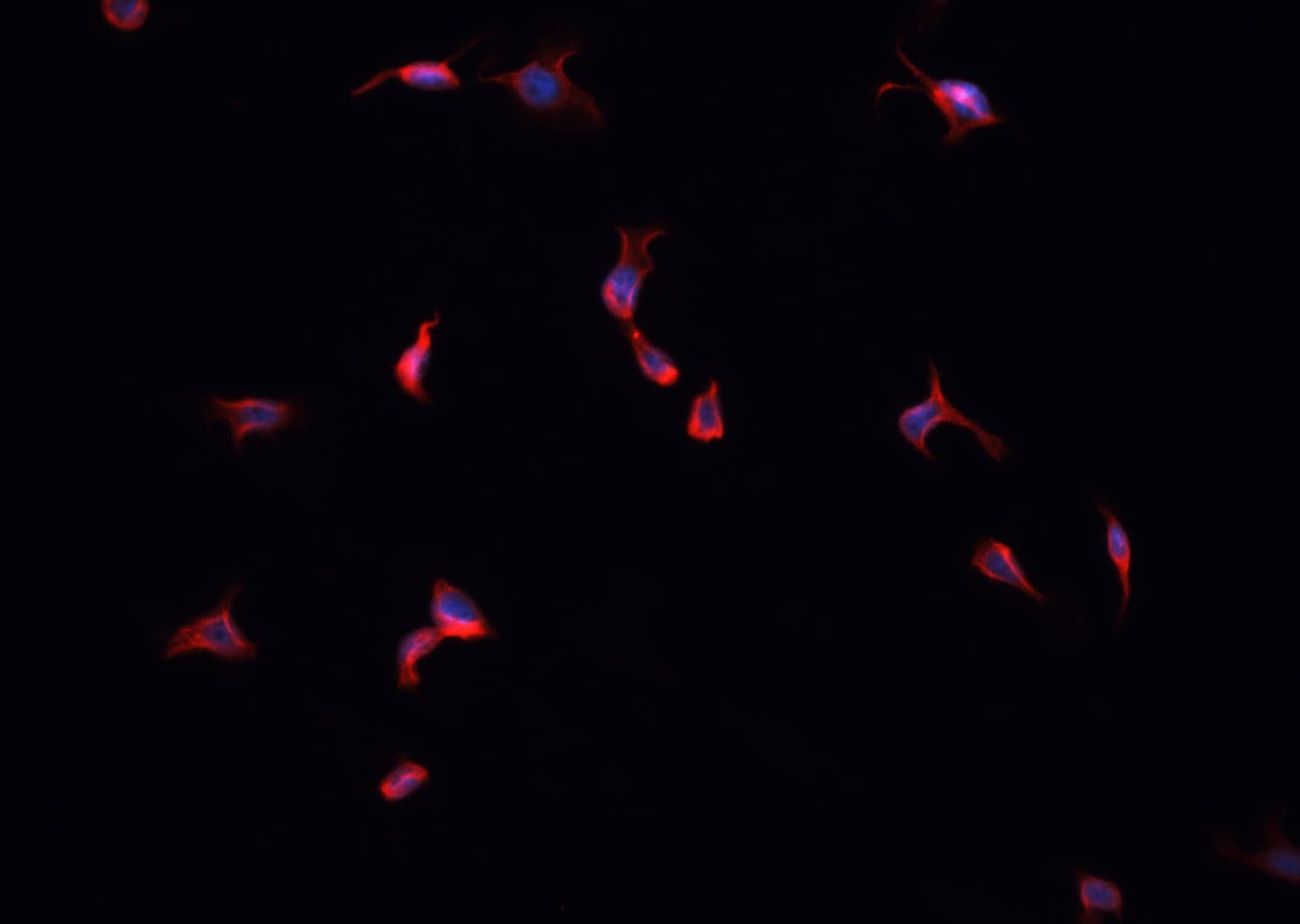 ERBB4 / HER4 Antibody