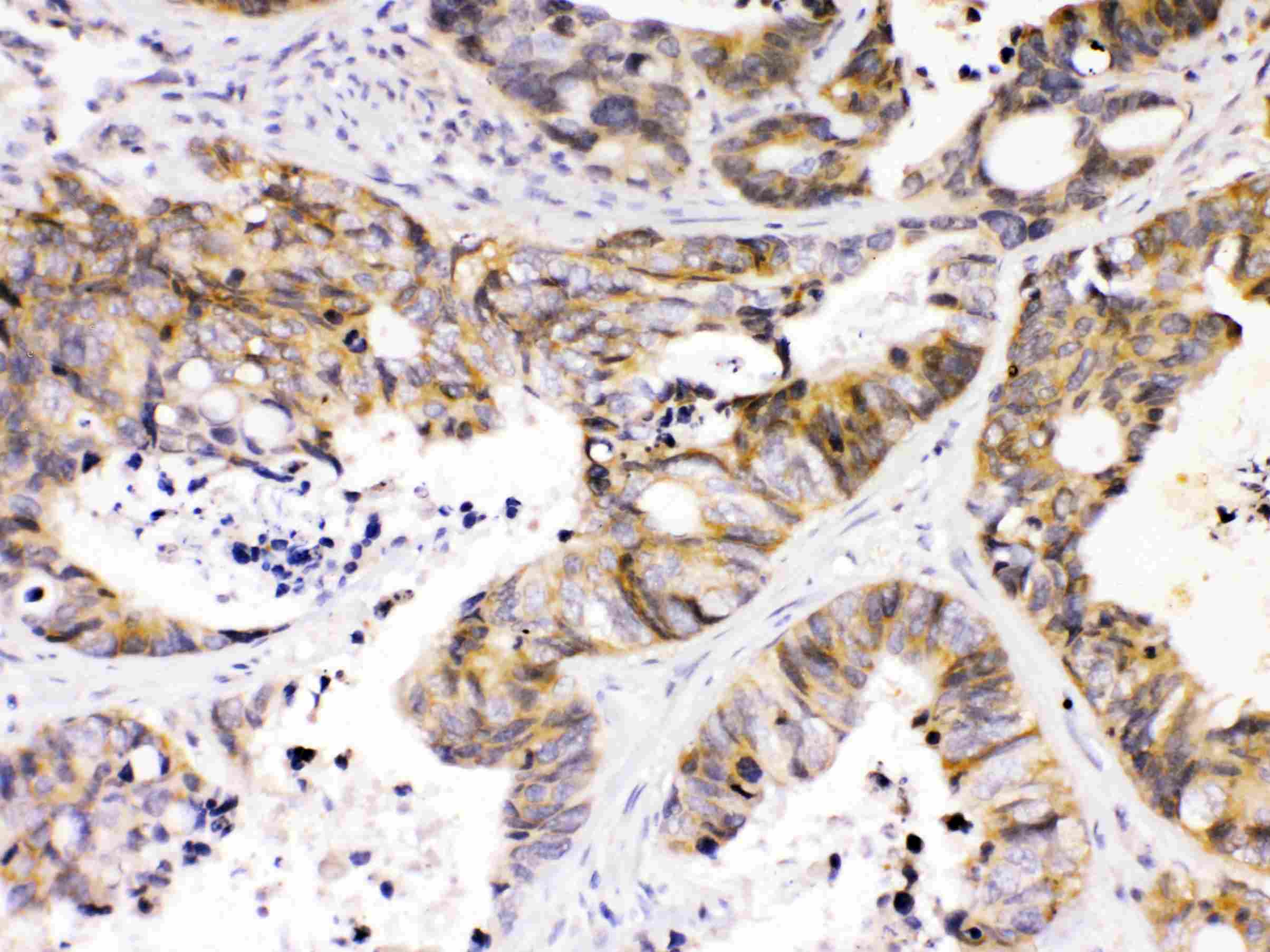 Polyclonal Rabbit anti-Human PAPD7 / TRF4-1 Antibody (IHC, WB)