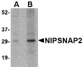 IHC-plus™ GBAS Antibody