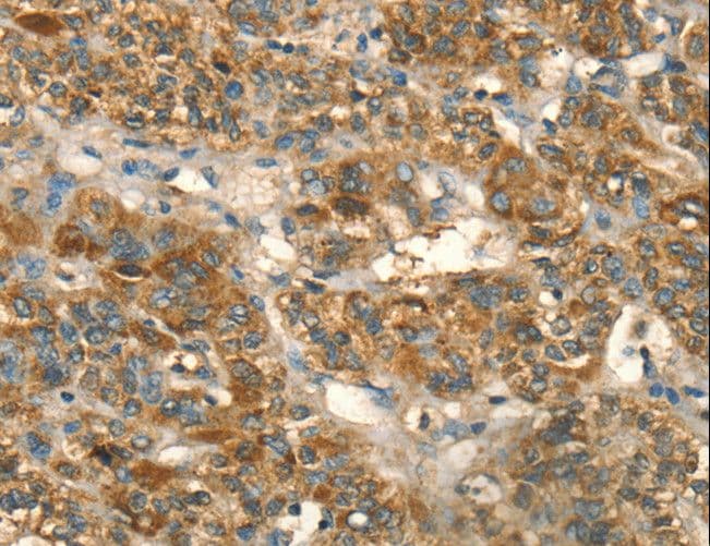IHC-plus™ HSD17B8 / RING2 Antibody