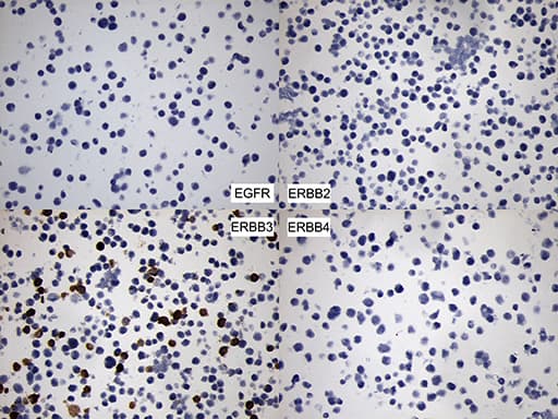 ERBB3 / HER3 Antibody (aa983-1342, clone OTI3C1)