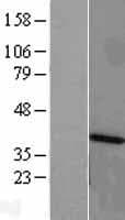 CARP / ANKRD1 Protein (Over-Expression Lysate Myc-DDK (Flag))