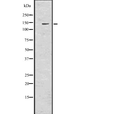 SALL4 Antibody