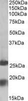 IHC-plus™ MPV17 Antibody (aa8-19)