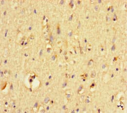 Polyclonal Rabbit anti-Human Neurotrypsin Antibody (IHC)