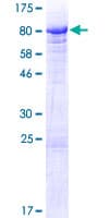 Human BANP Protein (Recombinant GST)