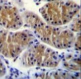 ANKEF1 / ANKRD5 Antibody (aa721-749)