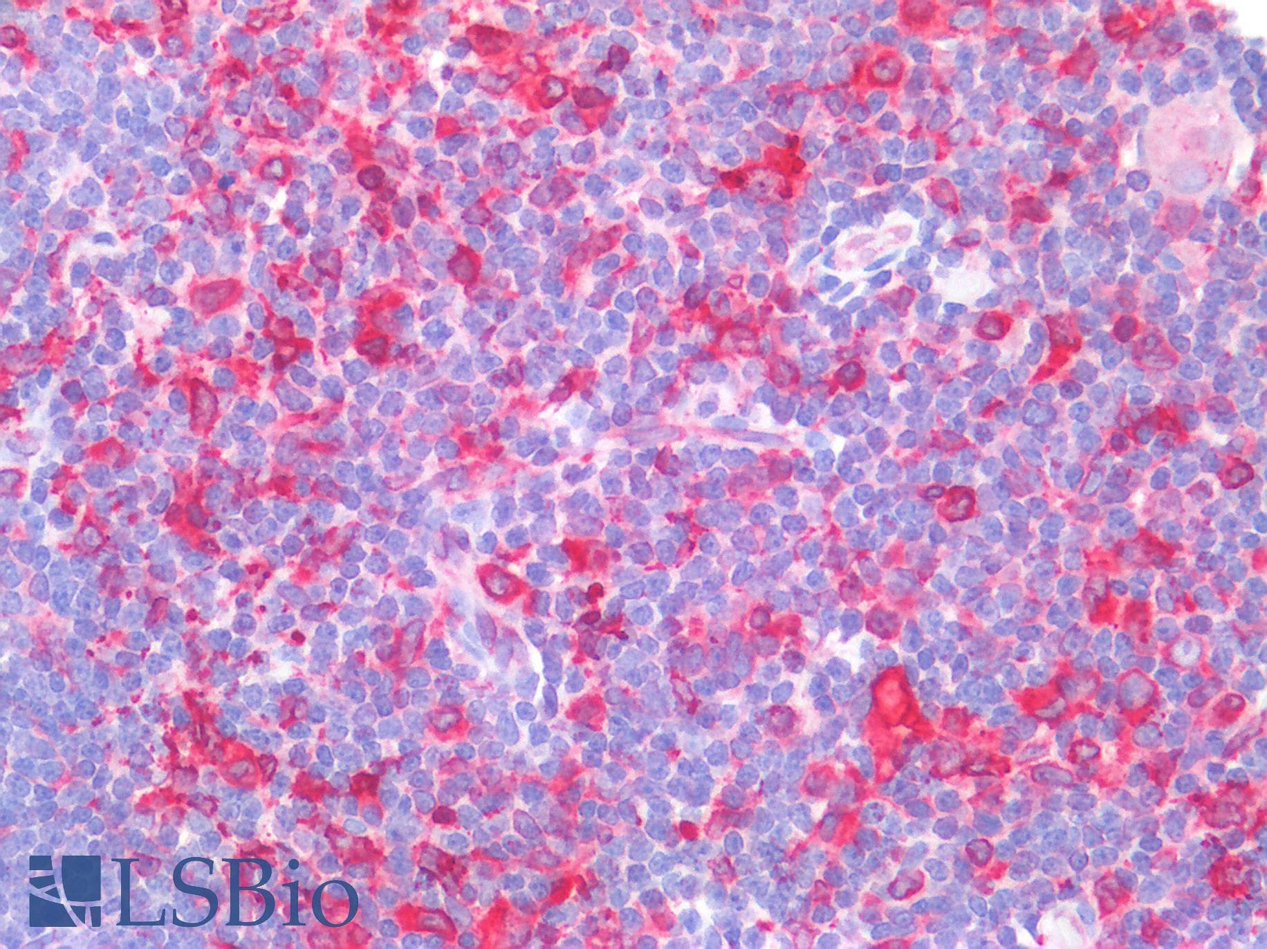 IHC-plus™ Polyclonal Goat anti-Human CD74 / CLIP Antibody (aa159-171, IHC, WB)
