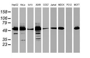 EPHX1 / Epoxide Hydrolase 1 Antibody (aa21-230, clone OTI3F11, Carrier-free)