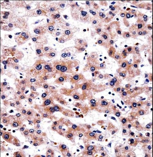 RCAN3 / Calcipressin 3 Antibody (aa194-222)
