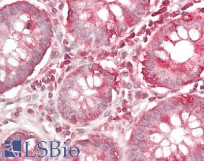 IHC-plus™ TRIP230 / TRIP11 Antibody (aa1929-1979)