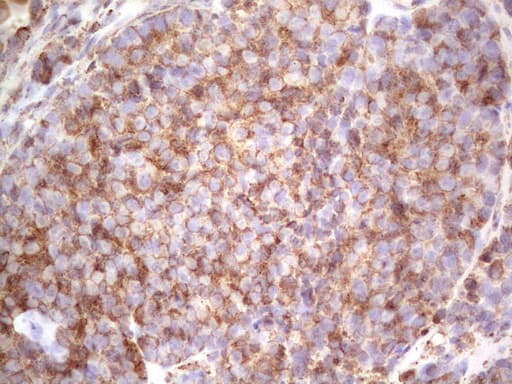RET Antibody (aa713-1017, clone OTI5F2)