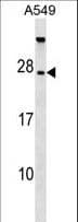 TBC1D28 Antibody (aa48-77)