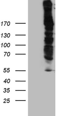 Polyclonal Rabbit anti-Human DSP / Desmoplakin Antibody (WB)